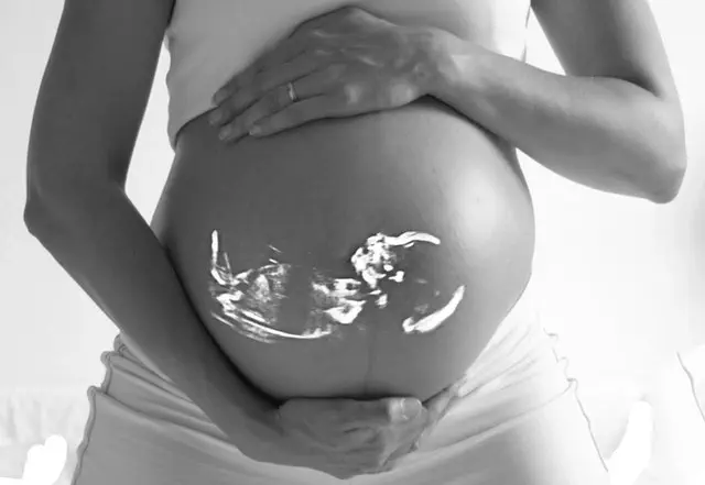 Analysis of the Abortion Amendment for Michigan